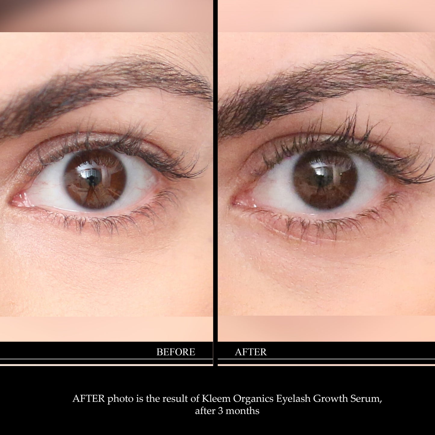 2-In-1 Eyelash And Eyebrow Growth Serum
